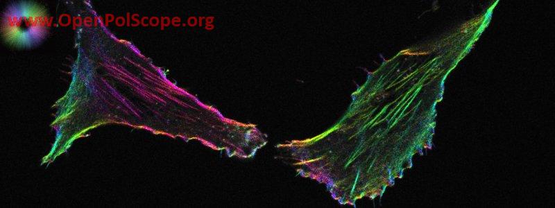 Optically sectioned orientation of filamentous actin in mammalian cells measured using confocal LC-PolScope. Image courtesy: Shalin Mehta, specimen courtesy: Felix Spira
